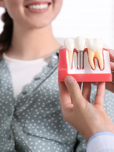 Tooth Replacement Services