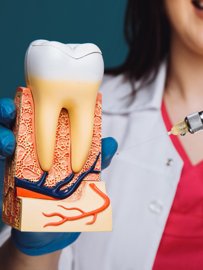 Root Canal Treatment