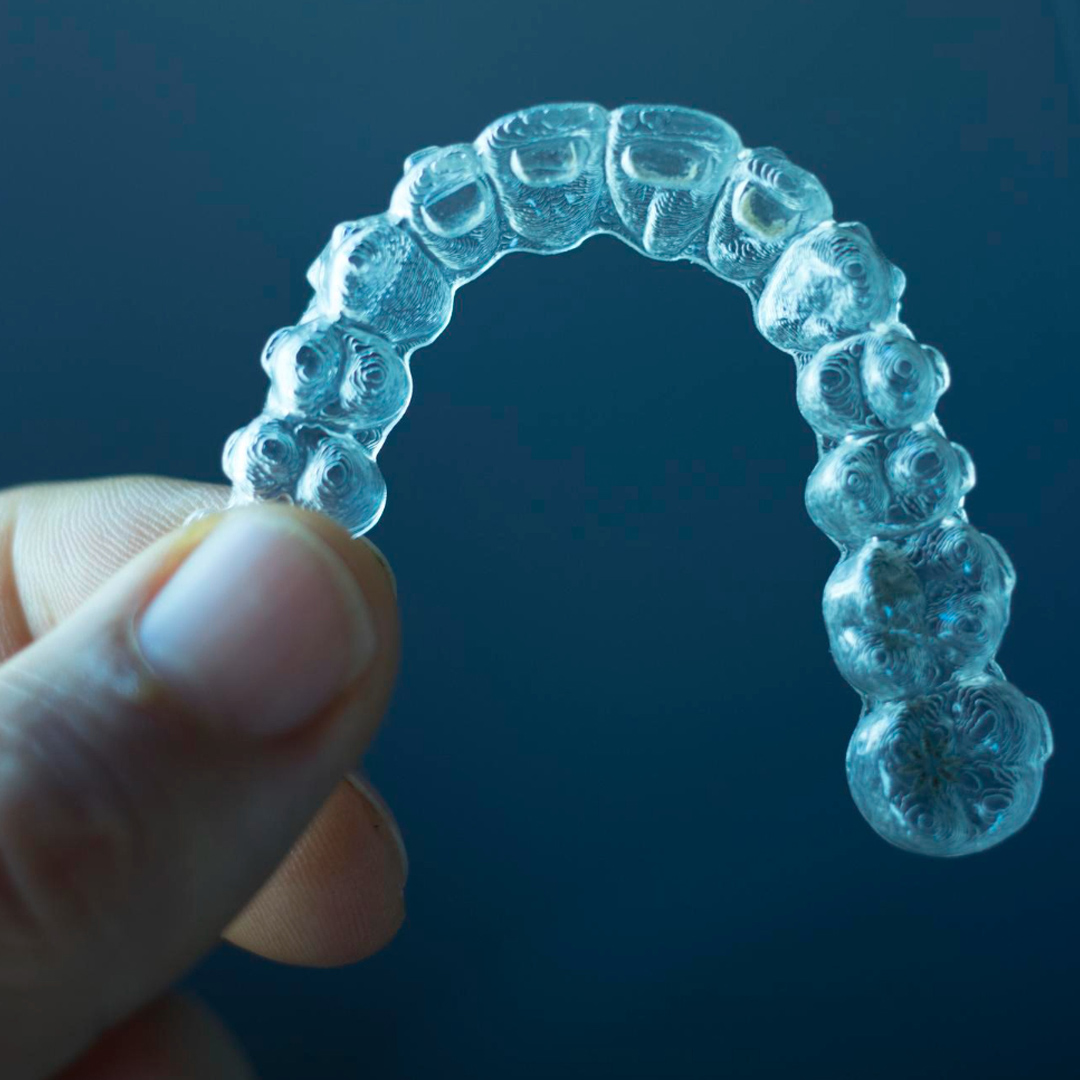 Dental Checkup